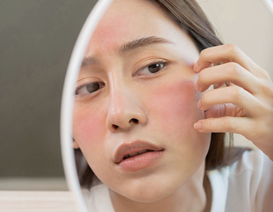 When a product stings on application, is the problem with in the product or your skin?