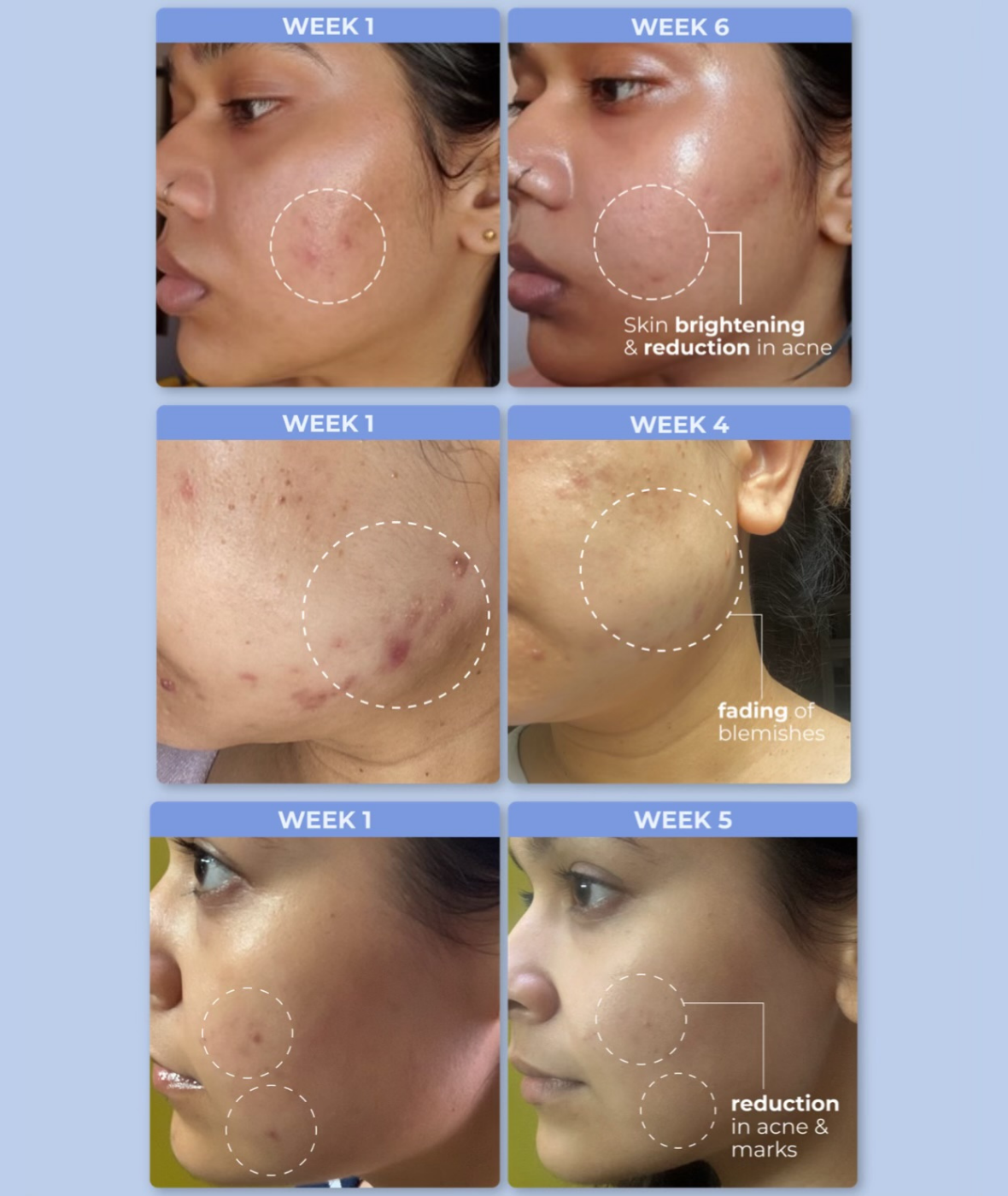 hustle (march 2026 expiry)